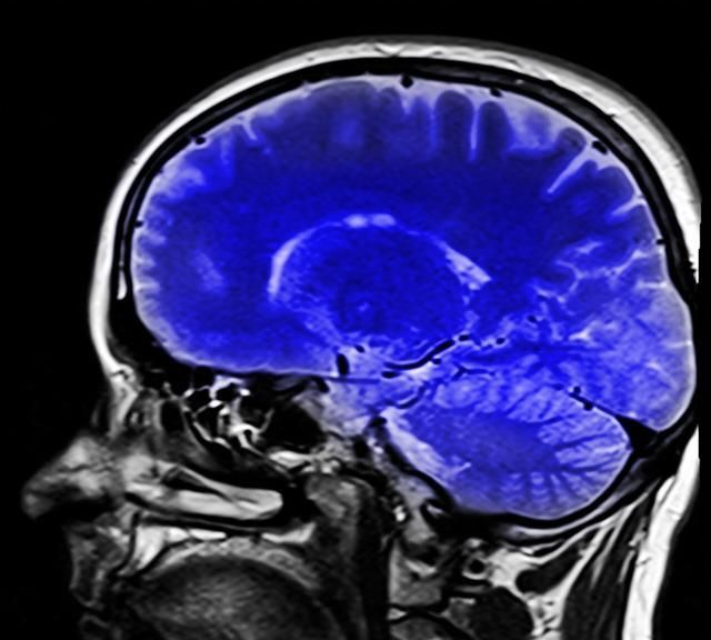 科学家：通过碳酸钙颗粒进行体内药物探测